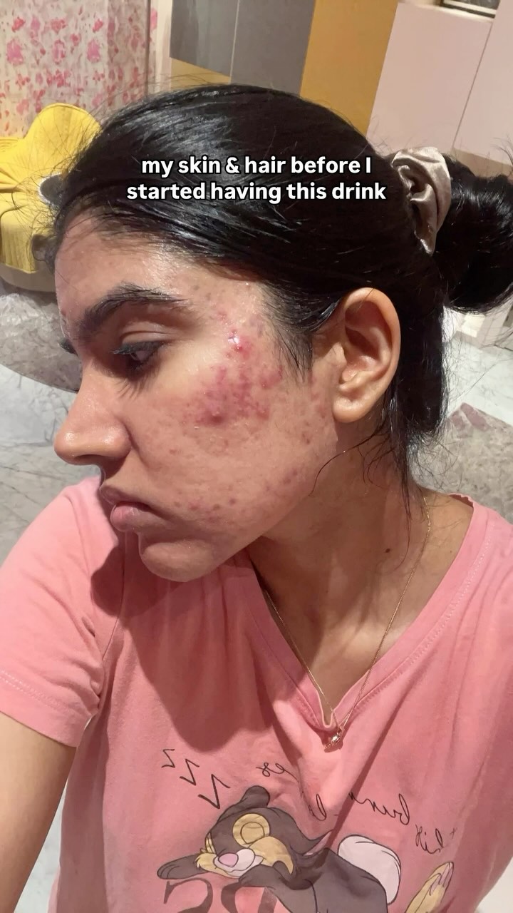 Amla Ginger Turmeric Drink